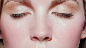 Comment soigner sa rosacée au naturel - Claire Andreewitch