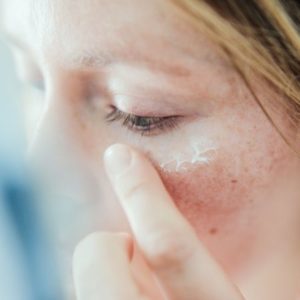 Comment soigner sa rosacée au naturel - Claire Andreewitch